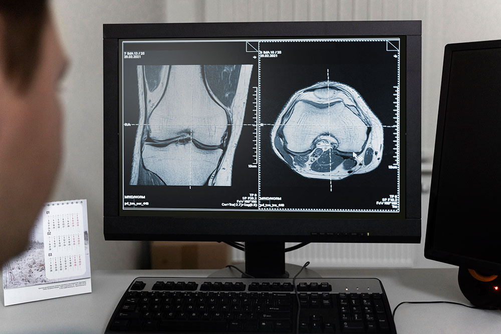 CT Scan Services